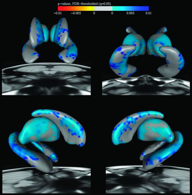 Fig 3.