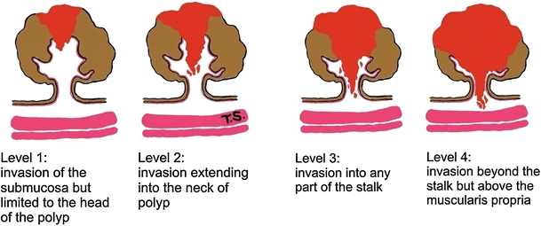 Fig. 2