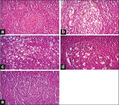 Figure-5