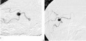 Figure. 2