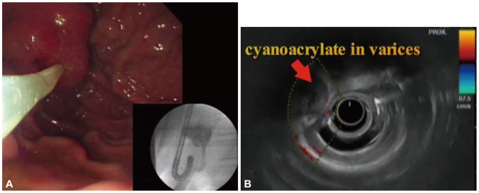 Fig. 2