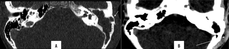 Figure 16