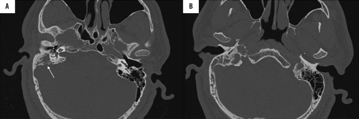 Figure 17