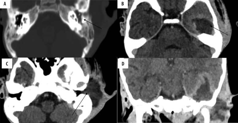 Figure 15