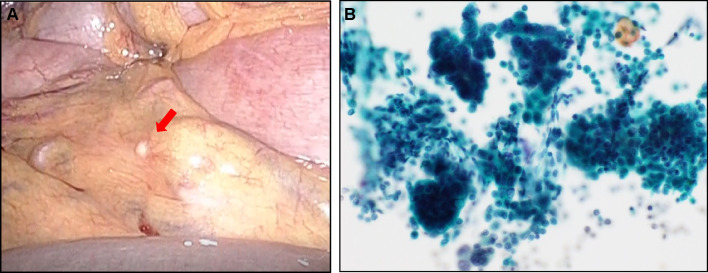 Fig. 1