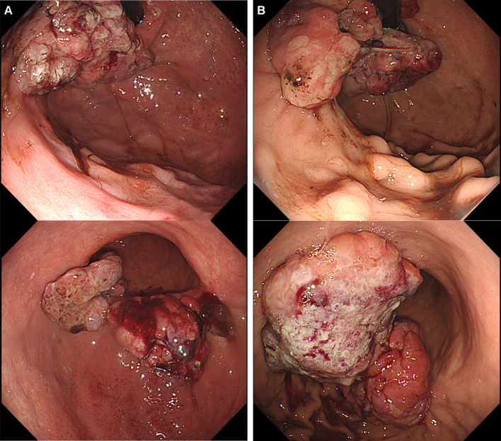 Fig. 2