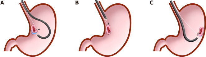 Figure 15