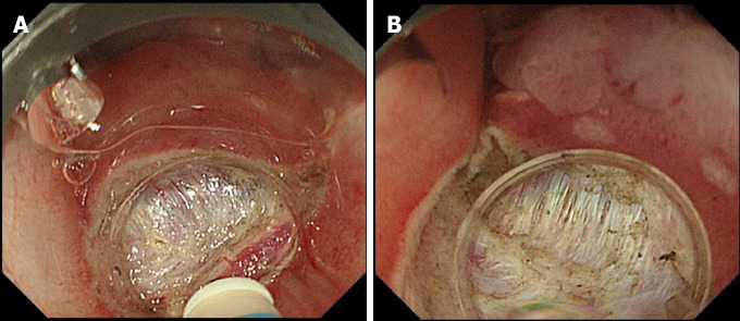 Figure 16