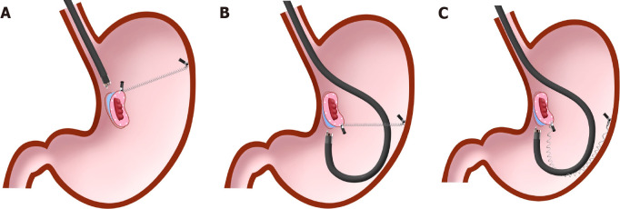 Figure 13