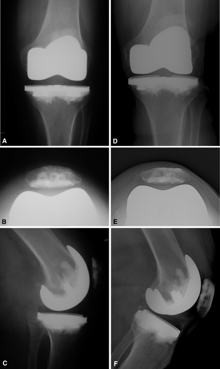 Fig. 1A–F