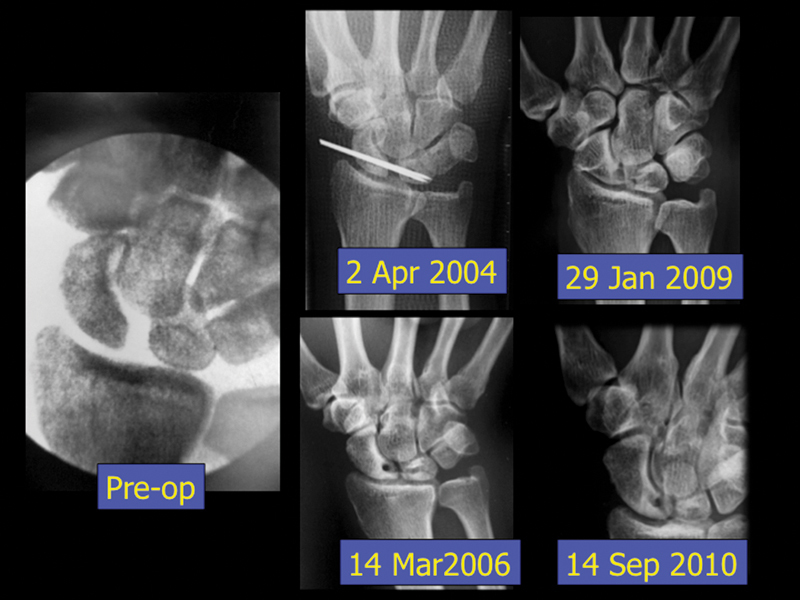 Fig. 16