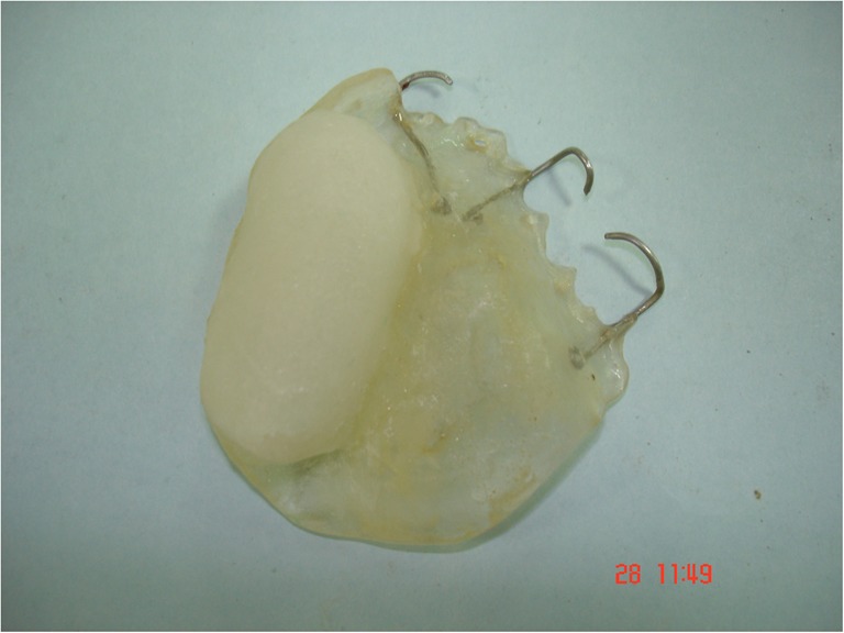 Fig. 4