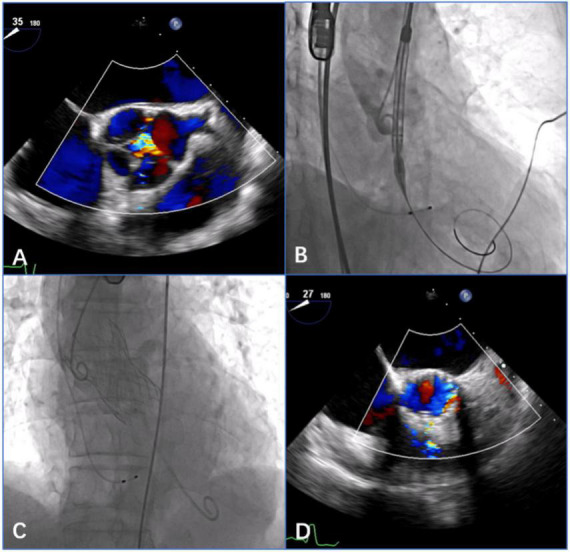 FIGURE 3