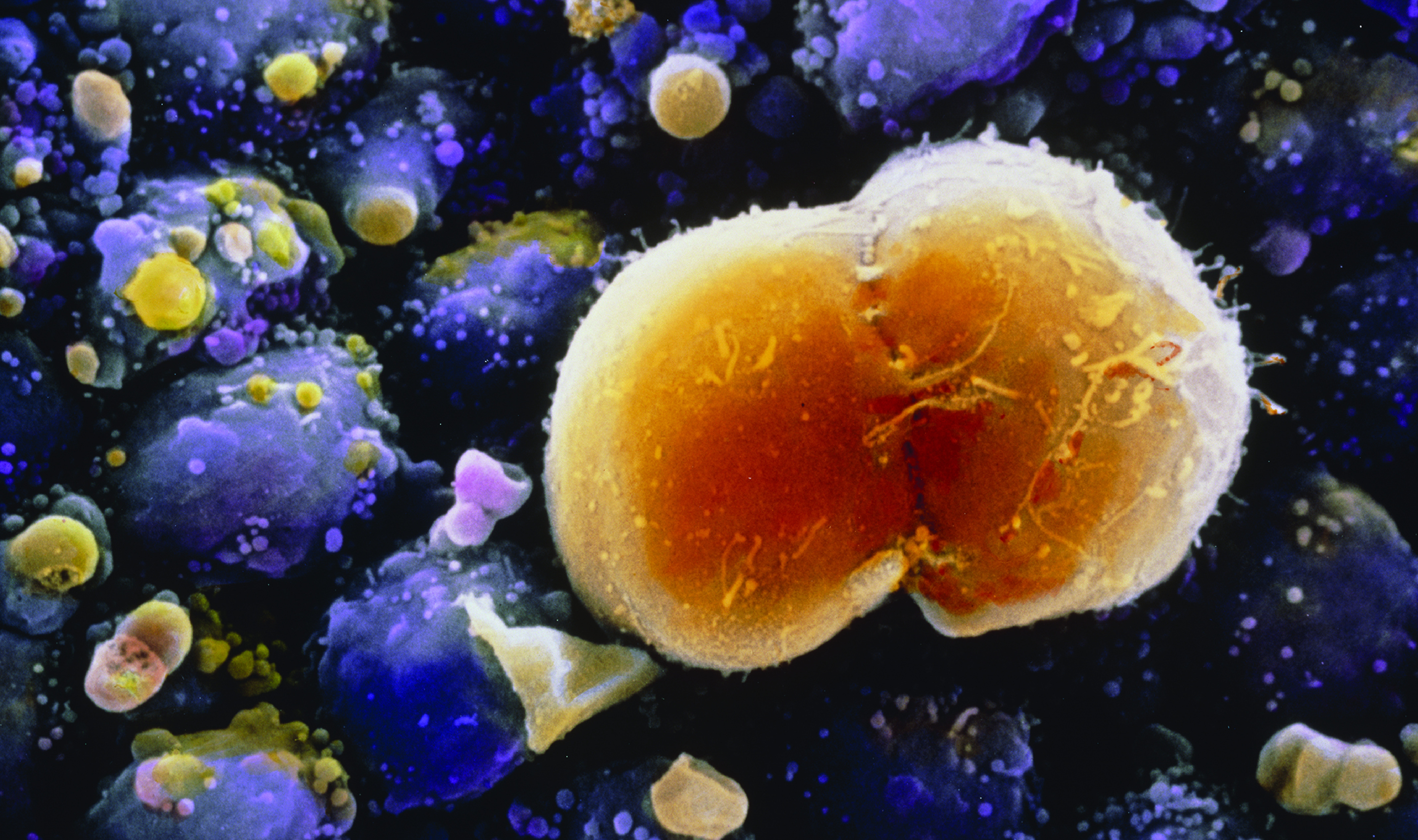 A magnified scanning electron micrograph image of cells evolving as oocytes.