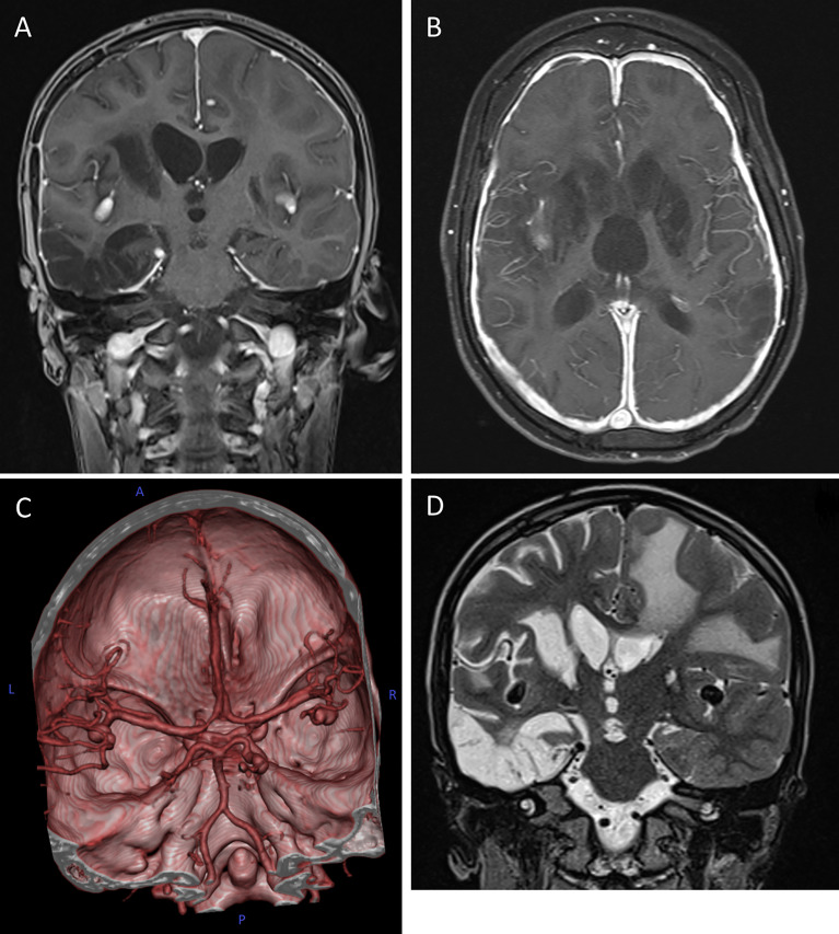 Figure 2