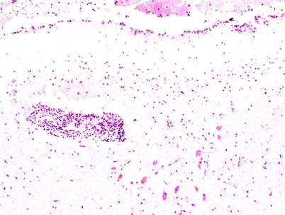 graphic file with name 194_2012_823_Fig4_HTML.jpg