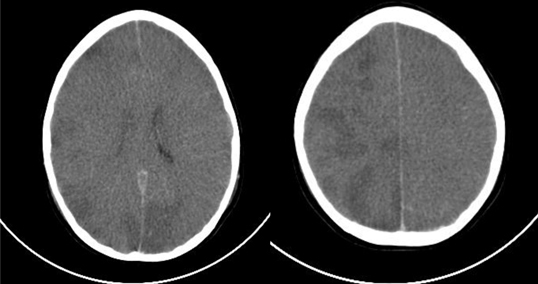 graphic file with name 194_2012_823_Fig1_HTML.jpg