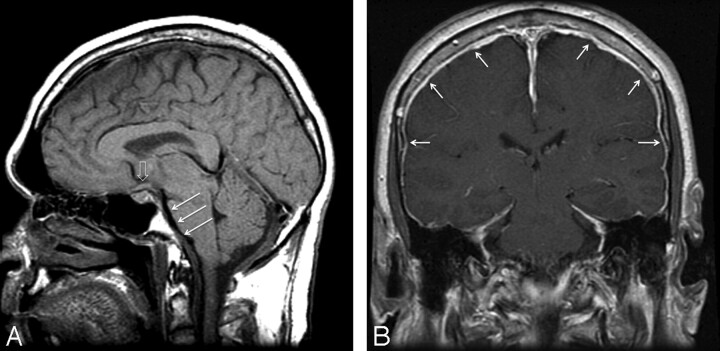 Fig 1.