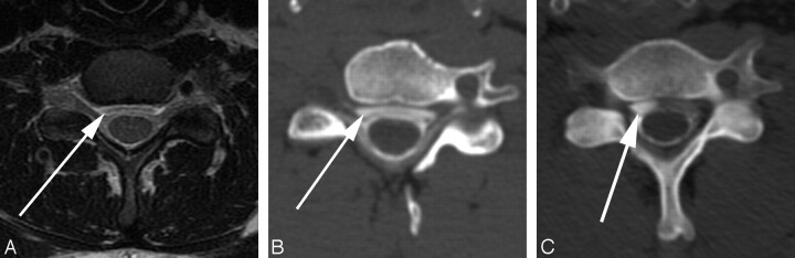 Fig 3.