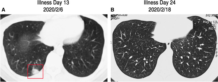 FIGURE 4