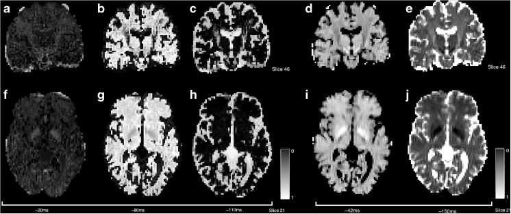 Fig. 9