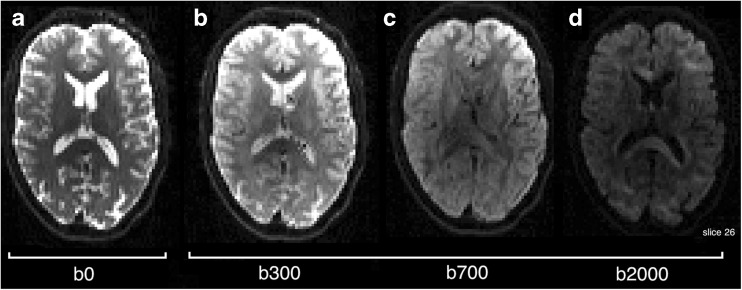 Fig. 11