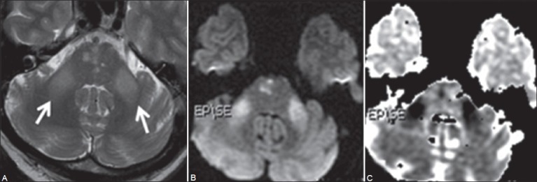 Figure 3 (A-C)