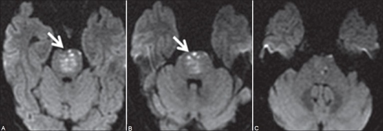 Figure 1 (A-C)