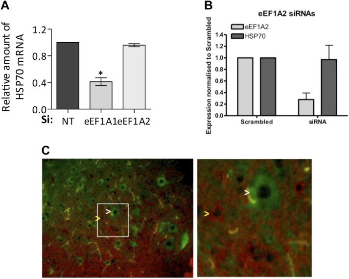 Figure 1—figure supplement 4.