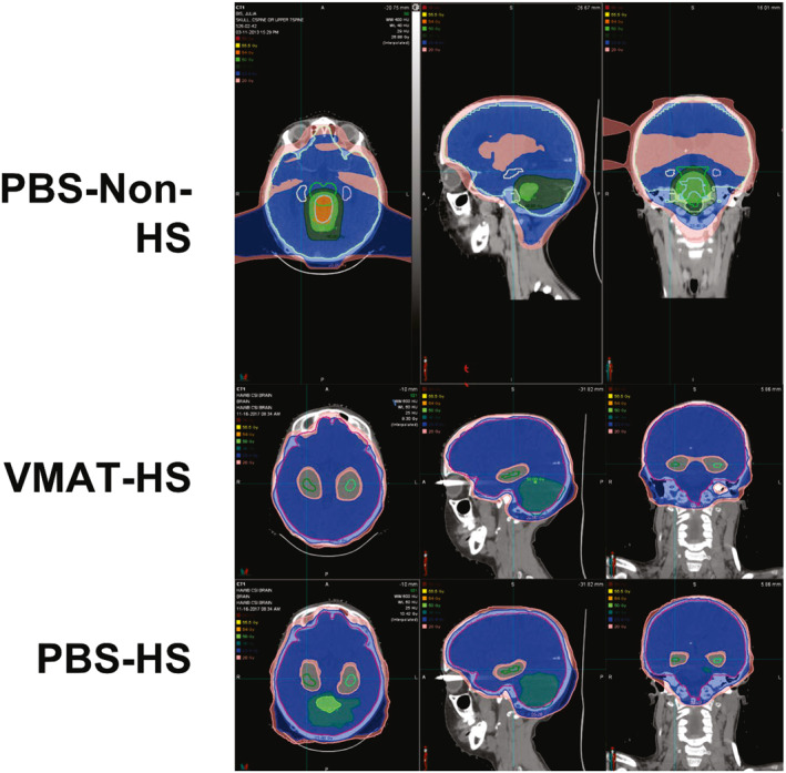 FIGURE 2