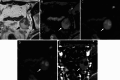 Fig. 15