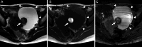 Fig. 13
