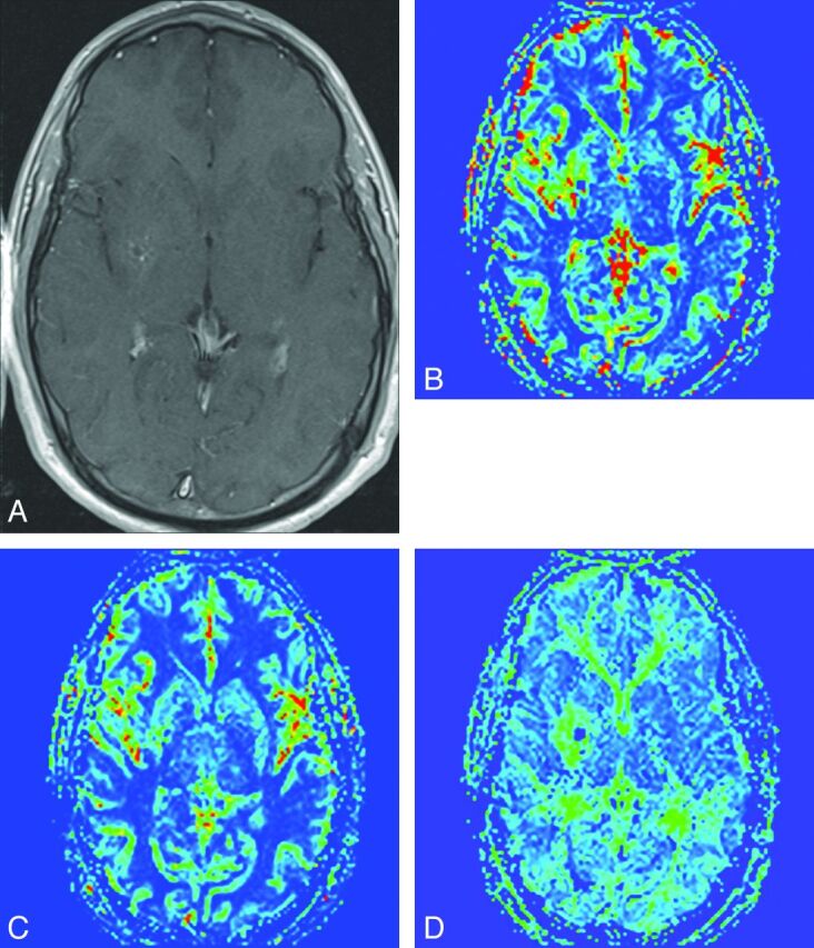 Fig 3.