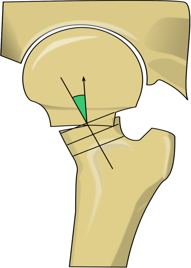 Fig. 3-B