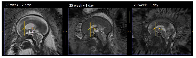 Figure 13. 