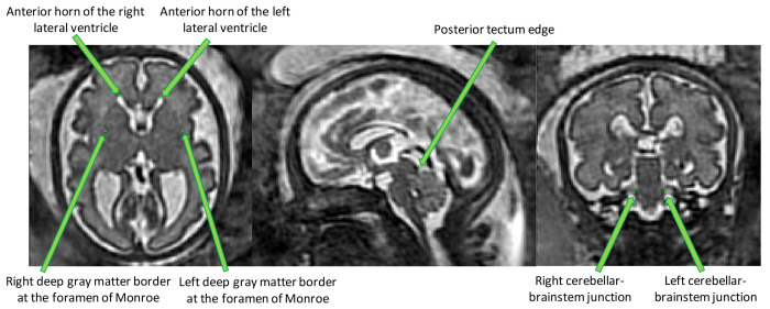 Figure 3. 