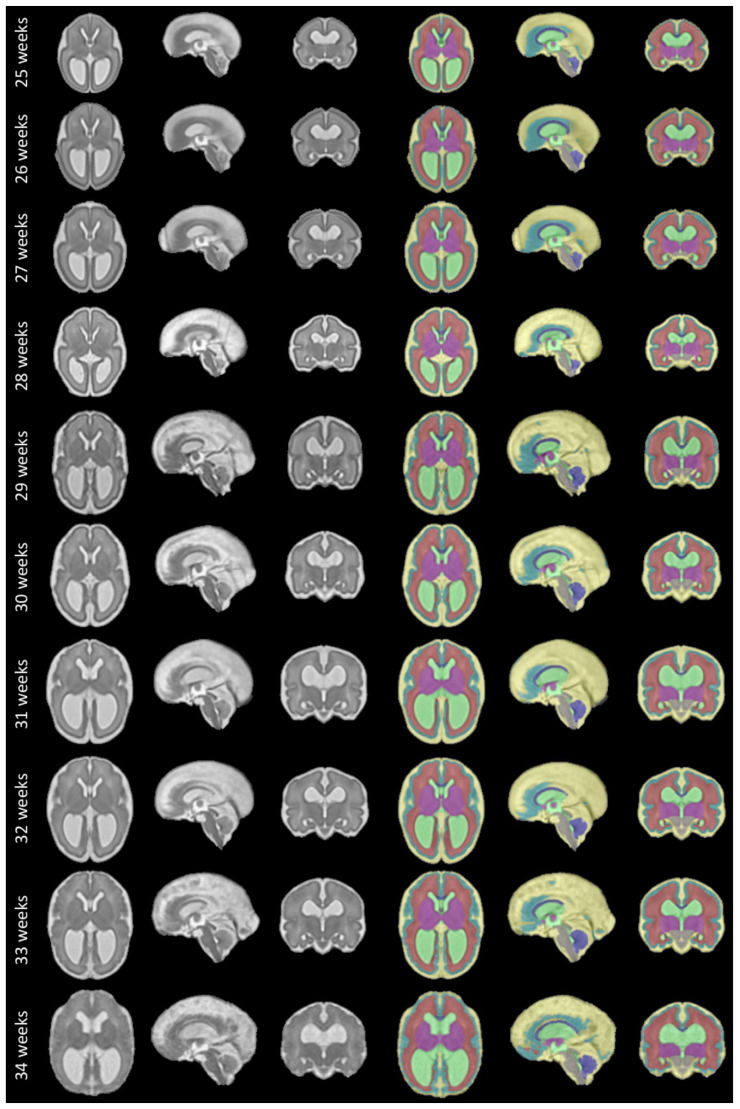 Figure 12. 