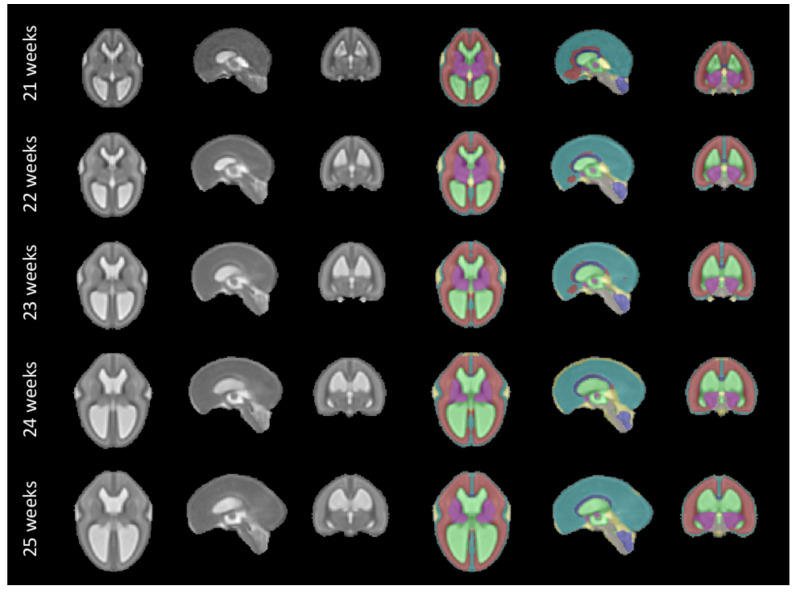 Figure 11. 