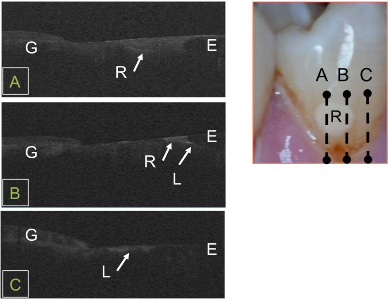 Fig. 6