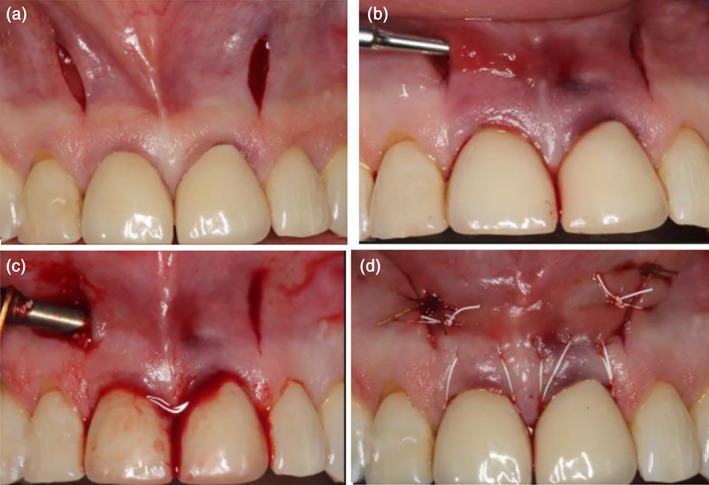 FIGURE 3