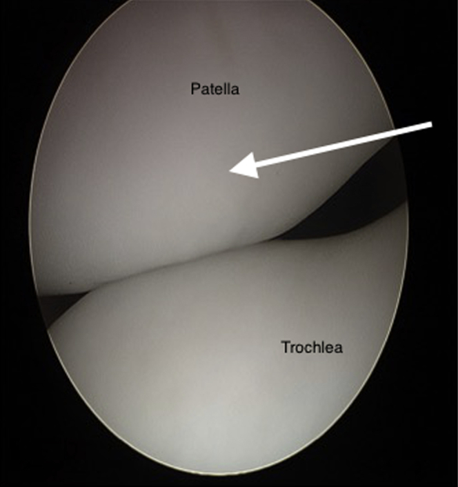 Fig 1