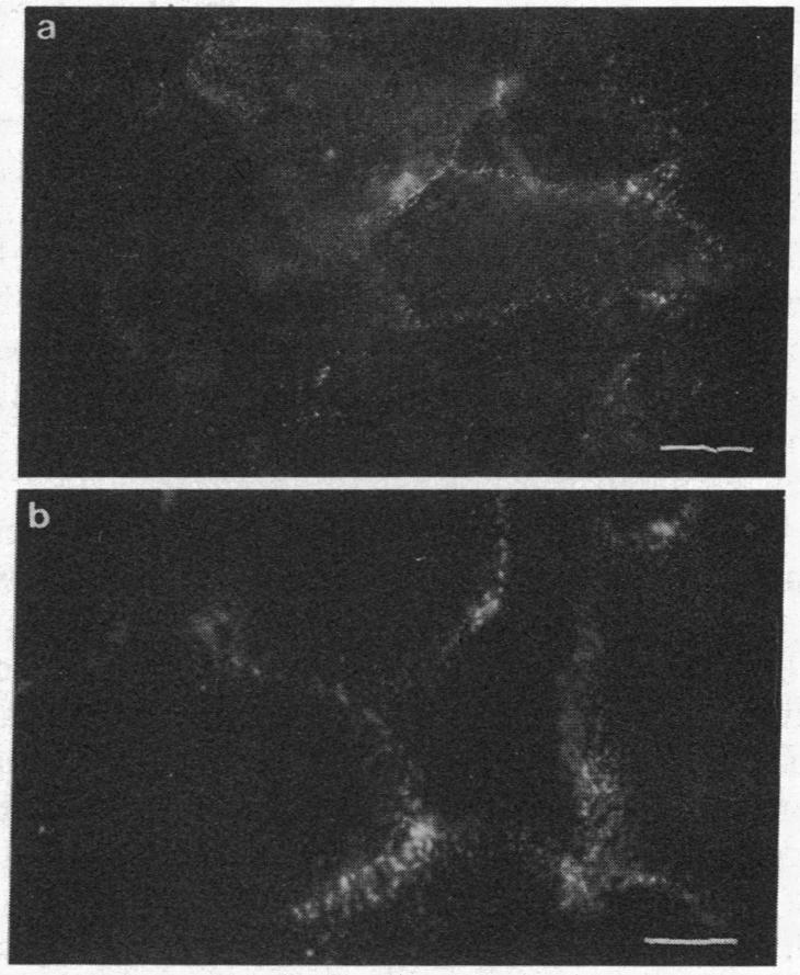 graphic file with name pnas00312-0385-a.jpg