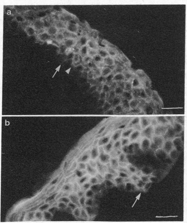 graphic file with name pnas00312-0385-c.jpg