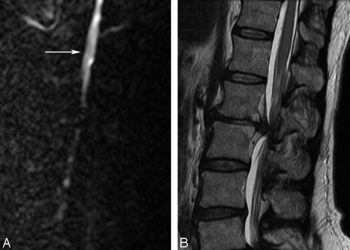 Fig 2.