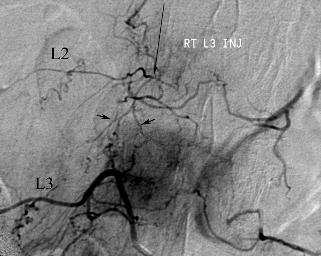 Fig 3.