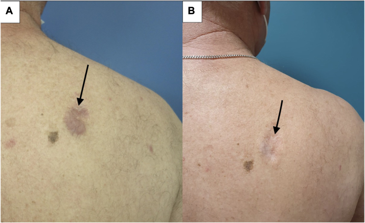 Fig 4