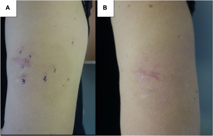 Fig 3