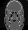 Figure 4: