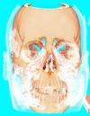 Figure 5: