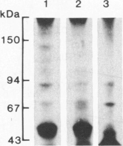 graphic file with name pnas00275-0224-a.jpg